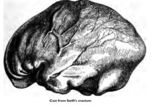 Black and white drawing of a cast of Johnathan Swift's cranium