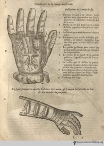 Iron hand designed by Ambroise Paré, famous barber-surgeon