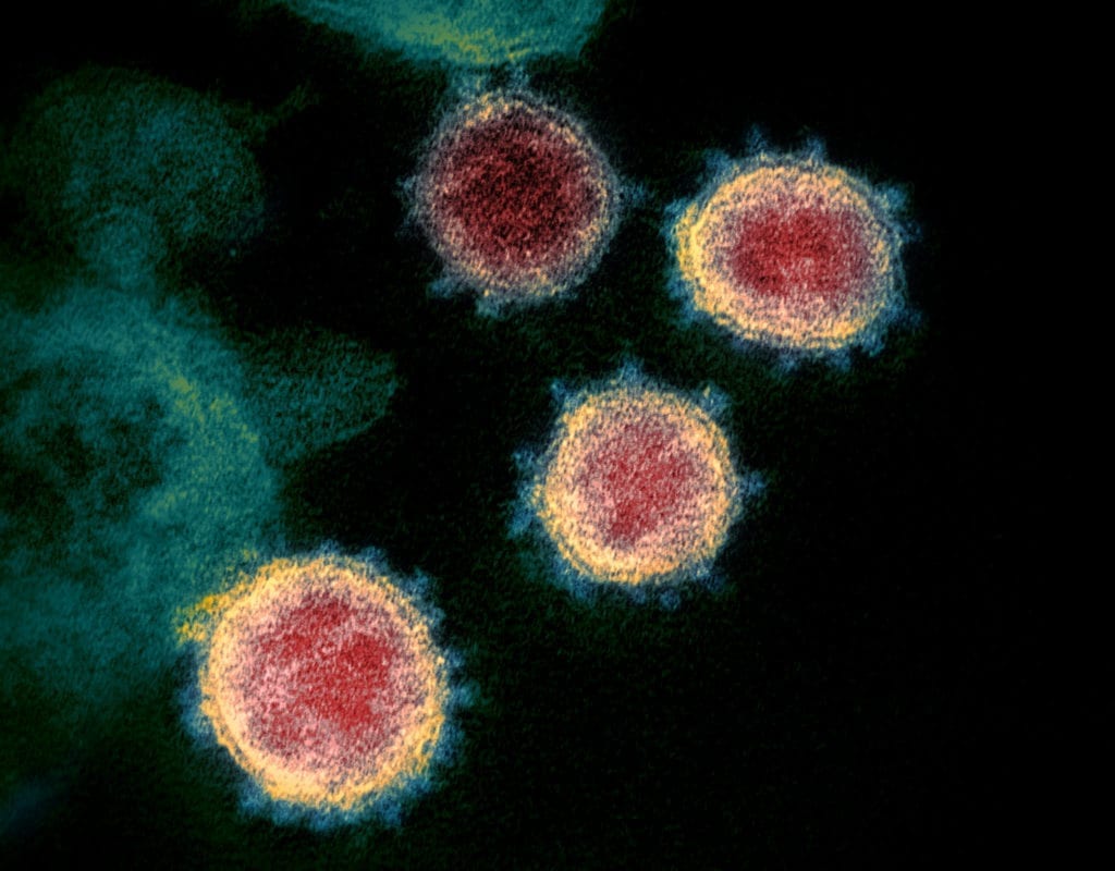 Novel Corona virus SARS-CoV-2