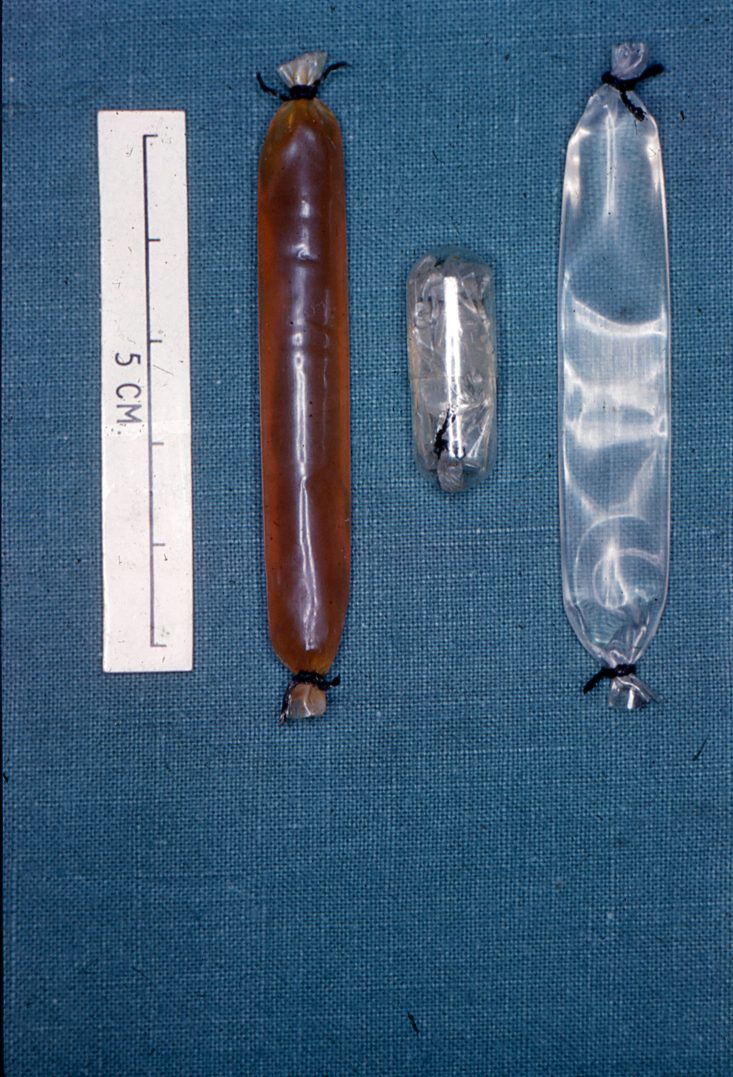 Sausage-like bags of clear, muddled, and brownish liquid (right to left)