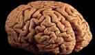 A photograph of the human brain. Link to the Neurology section.