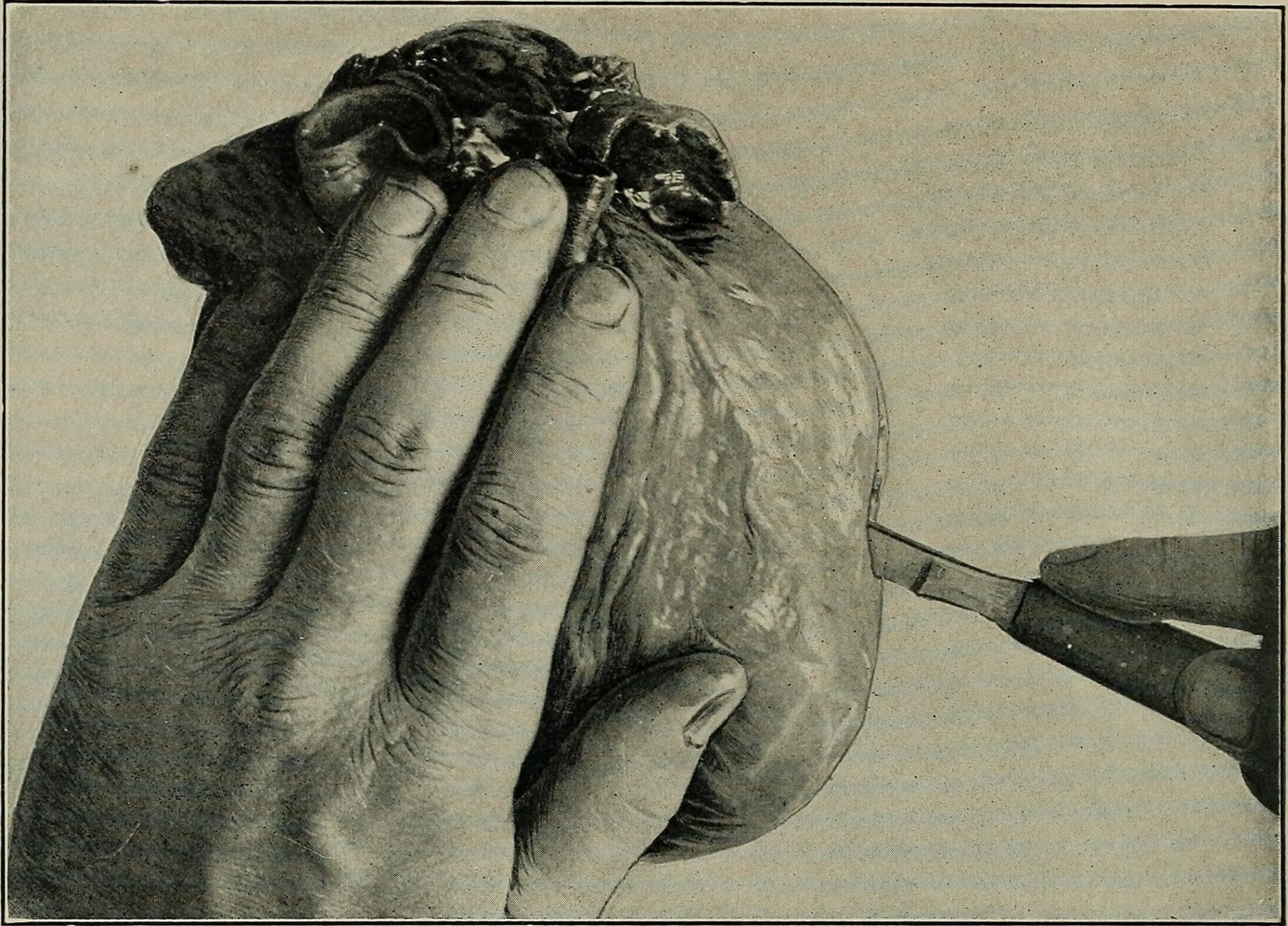 Photograph of dissection of the heart