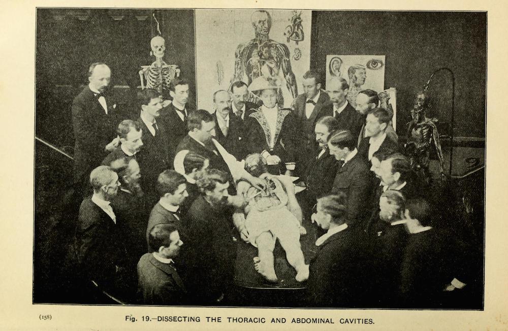 A group of students surround a body during a demonstration of embalming.