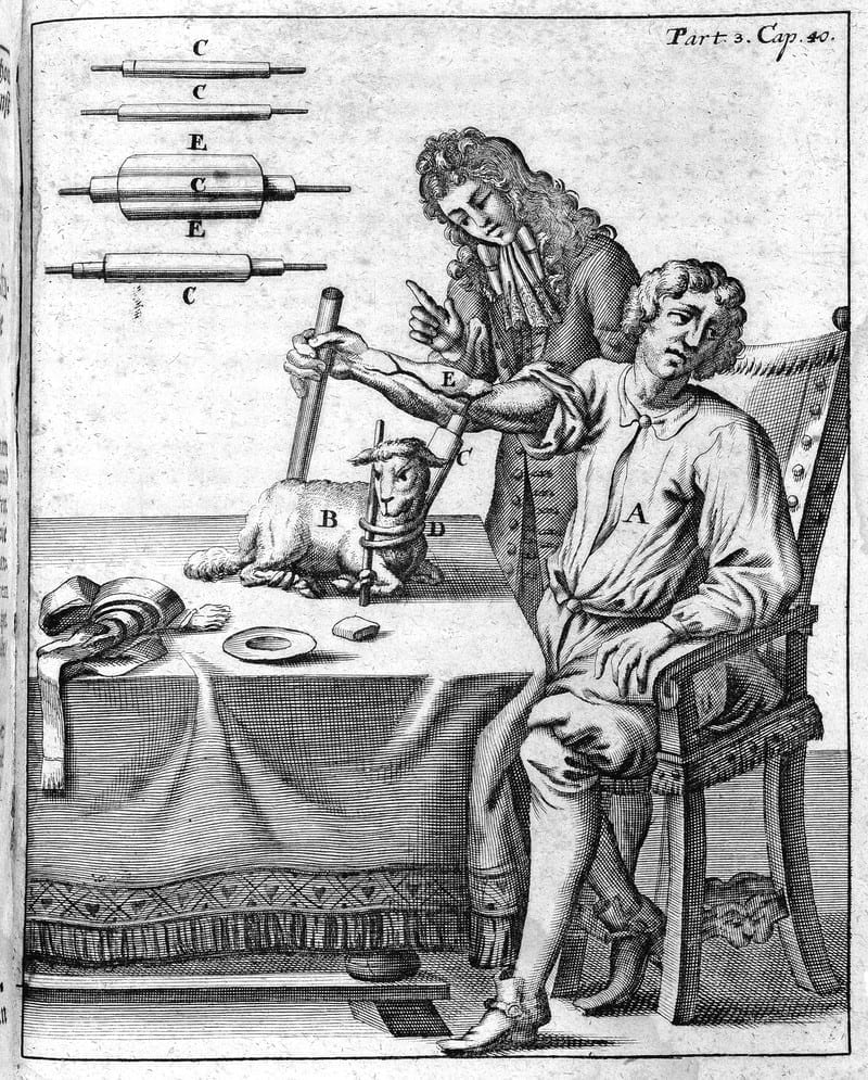 A man administering a transfusion between a tied lamb and a seated man who have an apparatus attached to their circulatory systems. Image for article on blood transfusion history