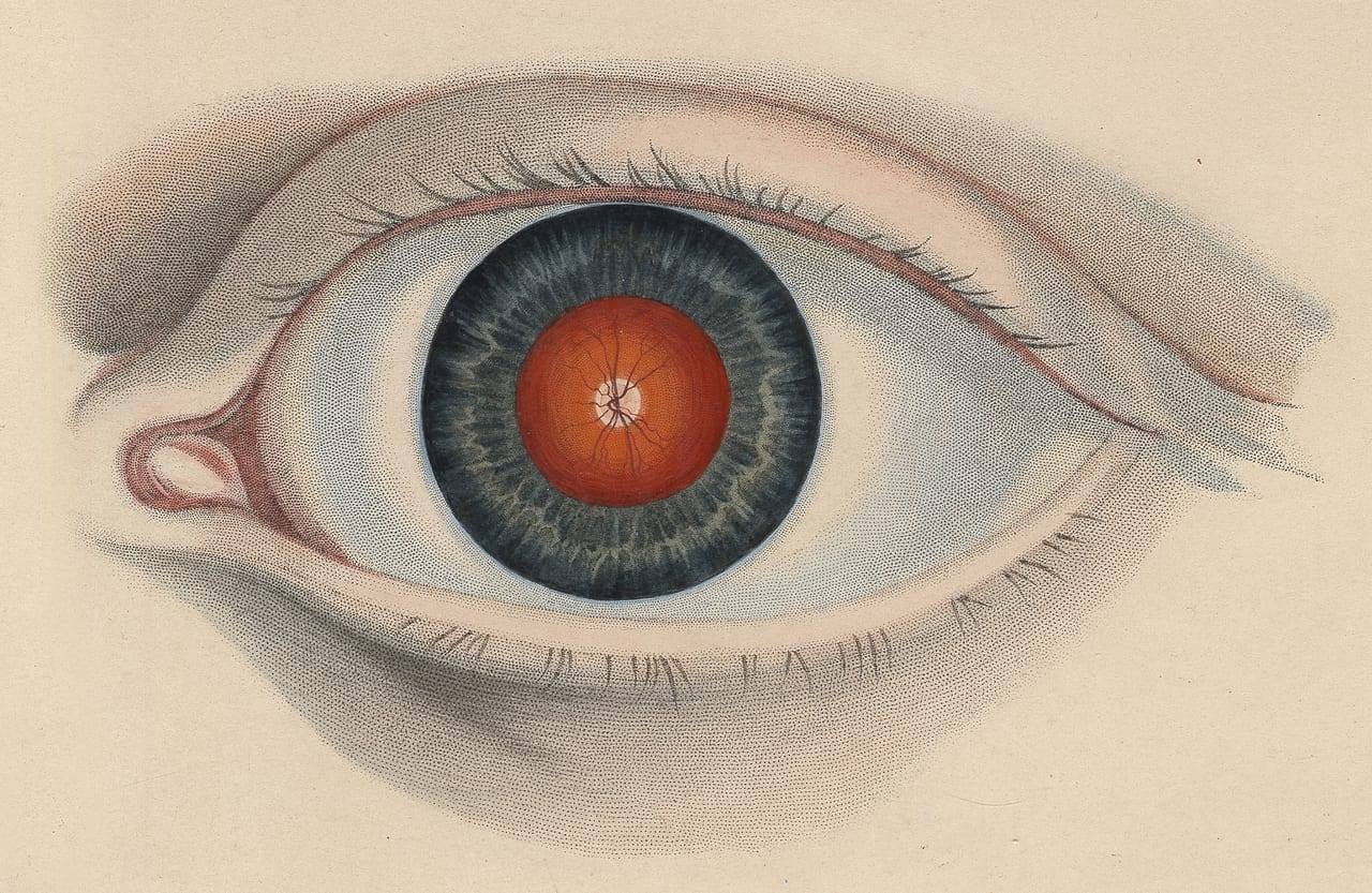 Color illustration of the eye as viewed through the ophthalmoscope
