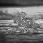 Electron microscope image of Treponema pallidum which causes syphilis. 