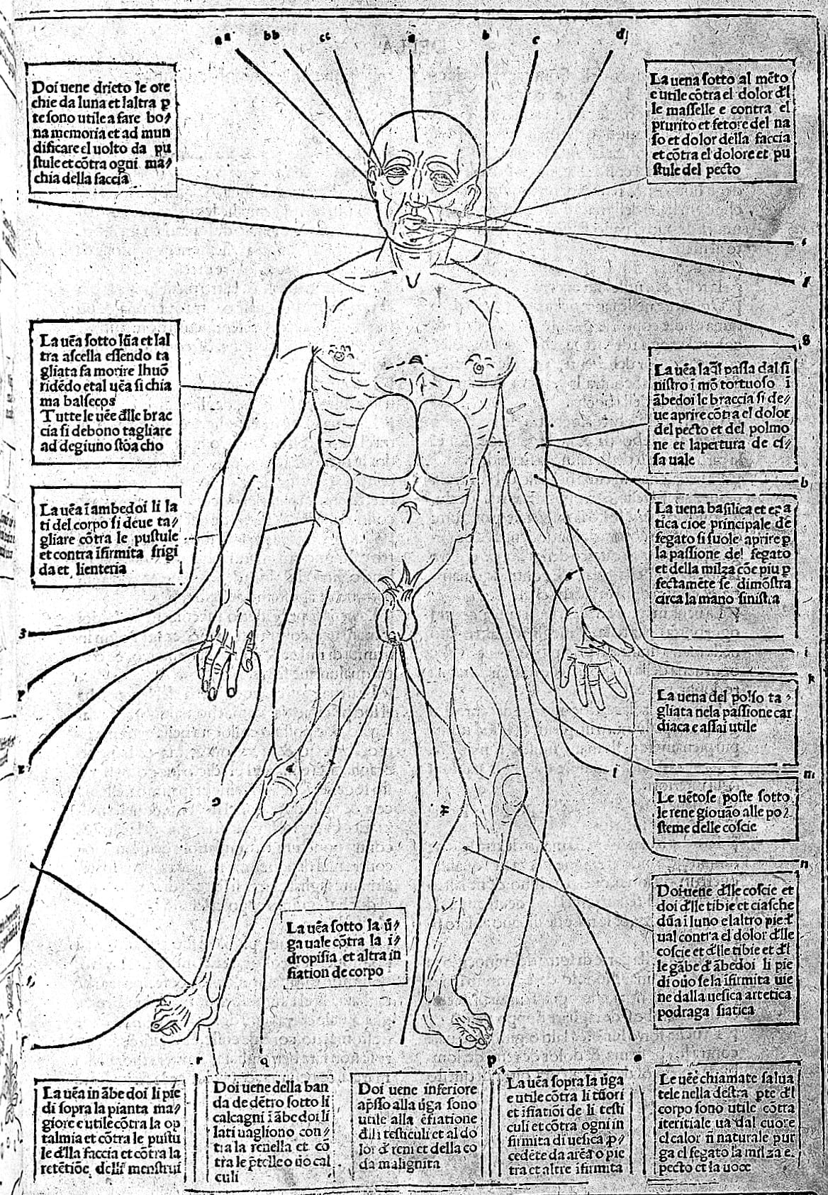 figure-2-woodcut-of-bloodletting-man-16-th-century-wellcome