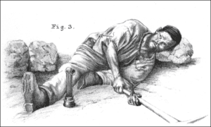 Illustration of a miner at work under conditions likely to cause nystagmus