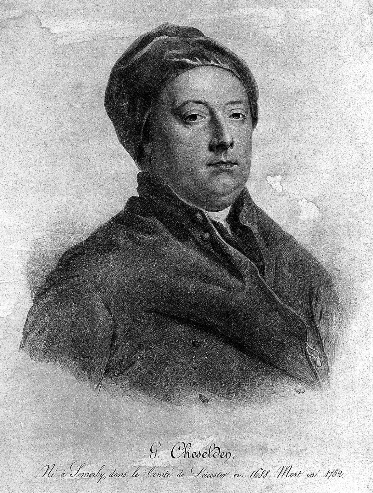 Portrait of William Cheselden
