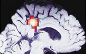 Brain scan-- showing modern neuroscience