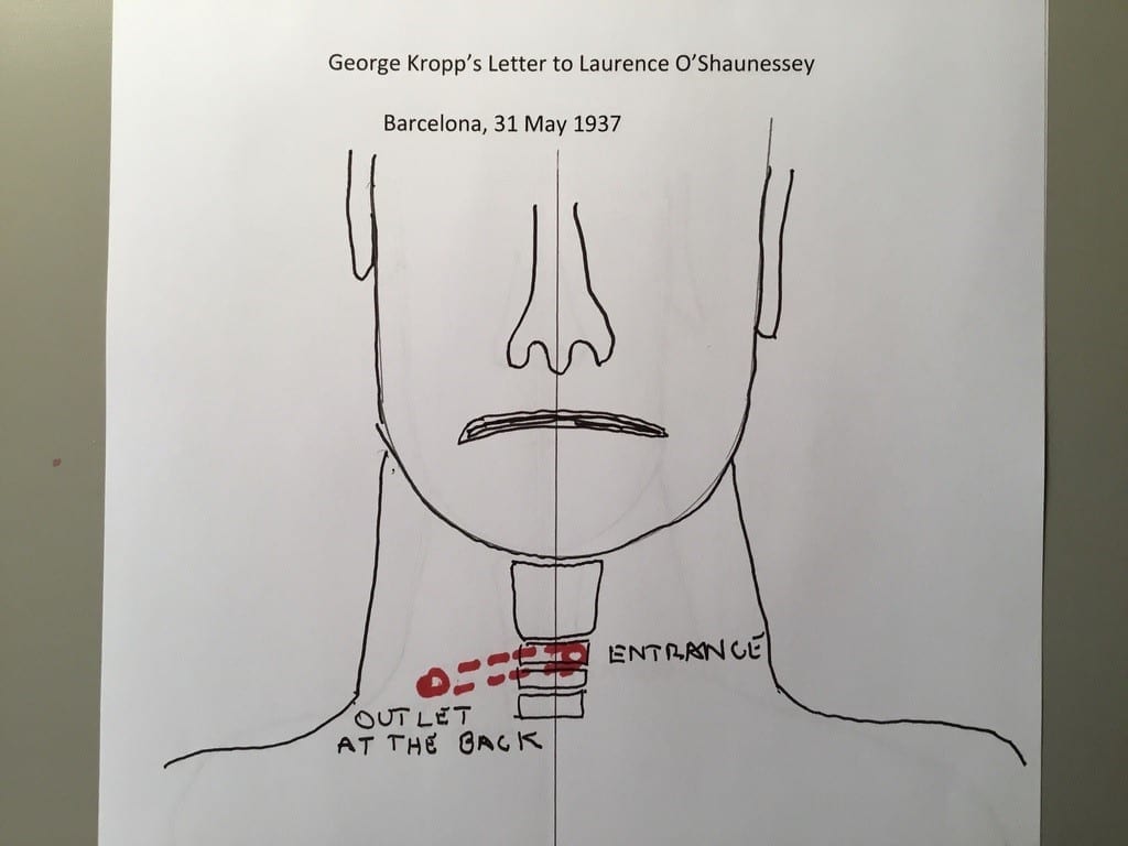 Illustration of George Orwell's neck wound