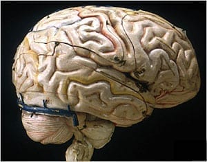 Brain sculpted by Louis Thomas Jerôme Auzoux