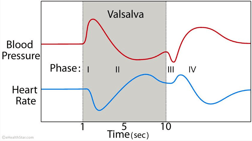 Diagram of blood pressuring during the Valsalva maneuver