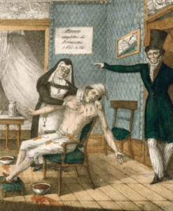 Illustration of leech treatment by Broussais