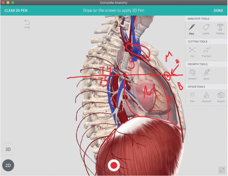 Digital approaches to teaching gross anatomy