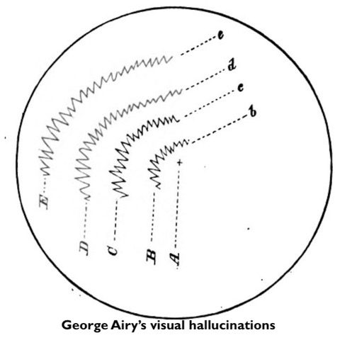 George Airy's illustration of migraine aura